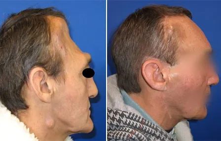 7 - Unité du cuir chevelu