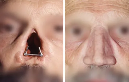 3 - Unité auriculaire