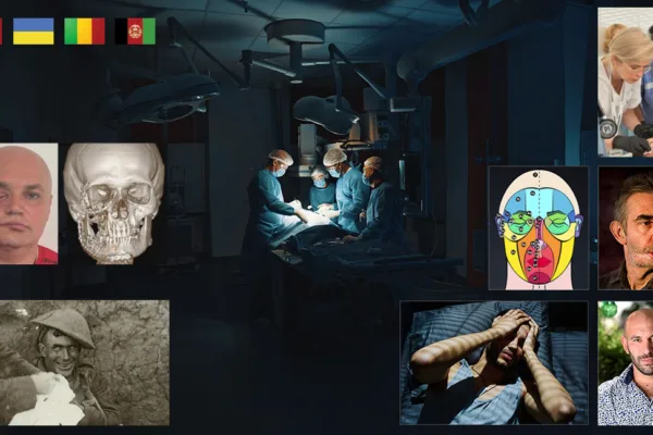 Les héros des temps modernes — Guerre et chirurgie maxillo-faciale