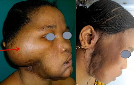 1 - Unité fronto-temporale