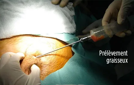 5 - Unité jugale (ou génienne)