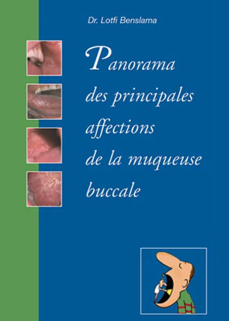 DERMATOLOGIE BUCCALE. PANORAMA DES PRINCIPALES AFFECTIONS
