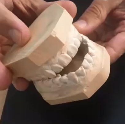 antécédent orthopedie dento faciale