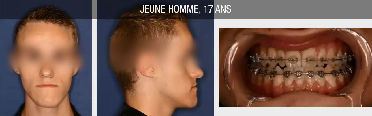 orthodontie maxillofacial