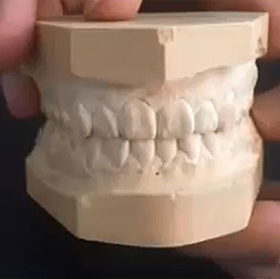 orthopedie dento faciale